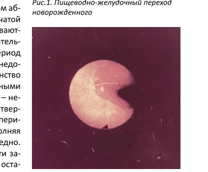 Зубчатая линия