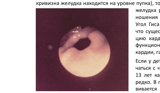 Привратник новорождённого