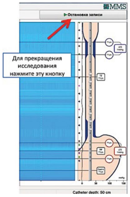 Окончание исследования