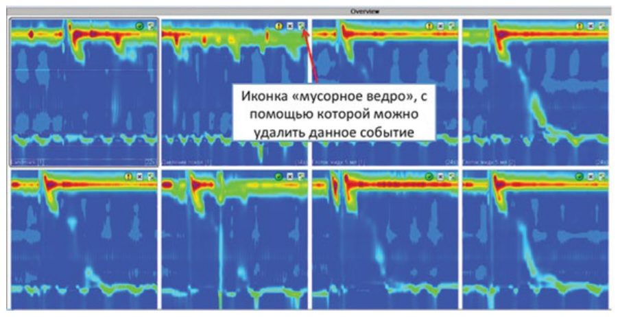Начальный этап анализа в режиме Overview: удаление ненужных событий